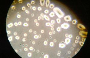 研究：帝王切開は赤ちゃんの拡大する微生物叢を変えないかもしれません